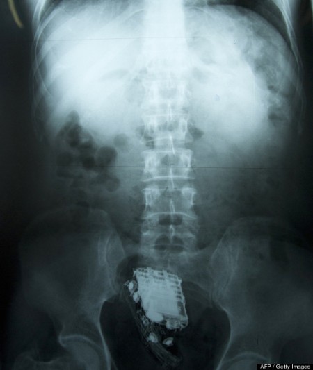 In this photograph received by AFP on February 8, 2013, a mobile phone and a hands free kit are seen in the rectum on an X-ray of a 58 year old Sri Lankan prisoner. A Sri Lankan prisoner. AFP PHOTO/ STRSTR/AFP/Getty Images