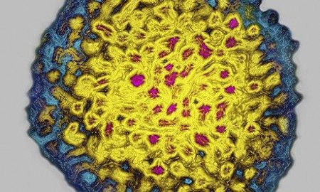 Hepatitis C virus seen through an electron microscope. Photograph: UIG/Getty