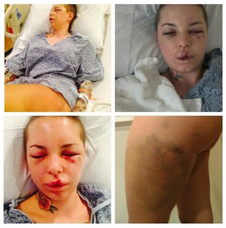 Christy Mack Describes Brutal Beating By War Machine (GRAPHIC PHOTOS)