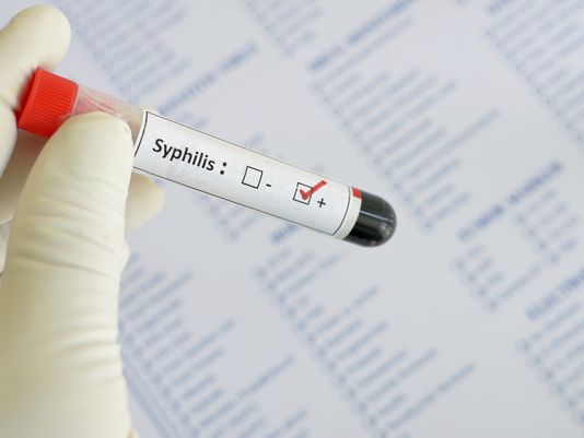 syphilis